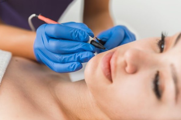 ThosrnHill Beaurty Clinic - Electrolysis